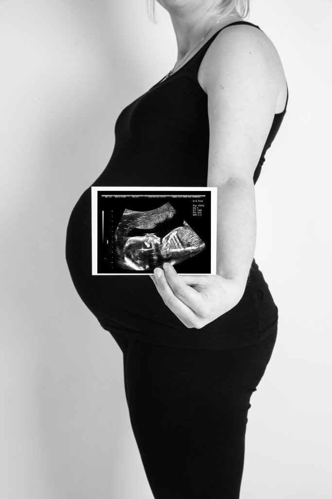 zwangerschapsfotografie echo